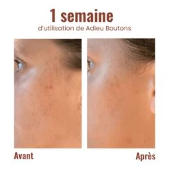 Roll-on Adieu Boutons -Maria Bonita Boutique hokaran adieu boutons4